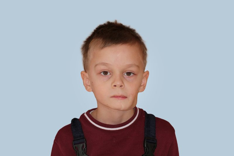 До лечения